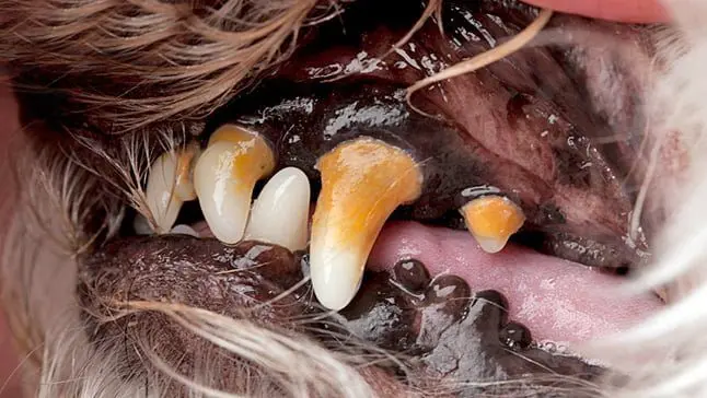 dientes con sarro
