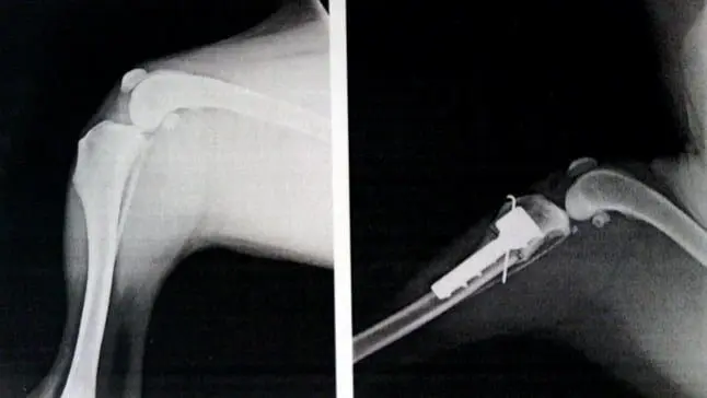 radiografia femur TTA